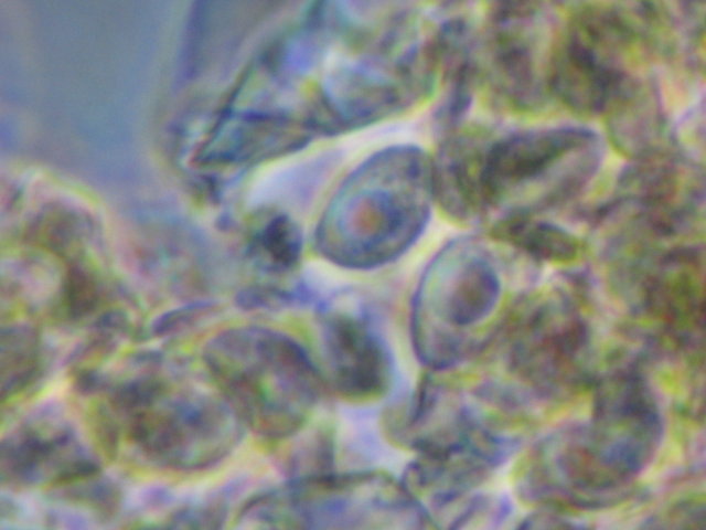 Botryobasidium con spore finemente verrucose